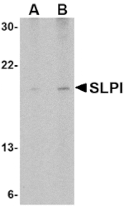 Western blot - SLPI Antibody from Signalway Antibody (24542) - Antibodies.com
