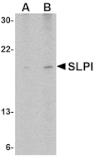 Western blot - SLPI Antibody from Signalway Antibody (24542) - Antibodies.com