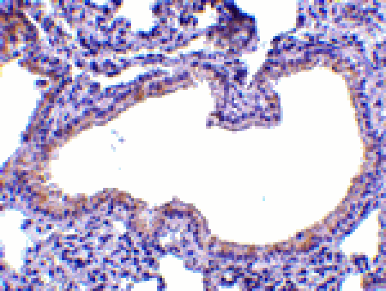 Immunohistochemistry - SLPI Antibody from Signalway Antibody (24542) - Antibodies.com