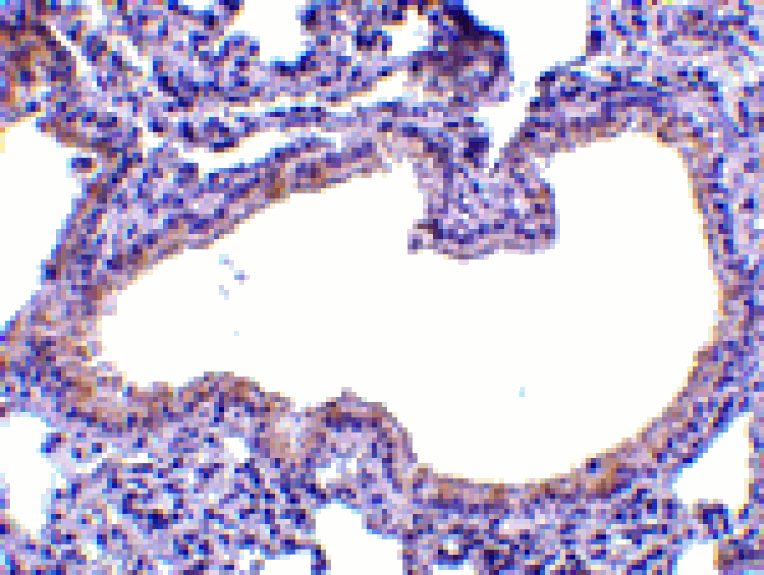 Immunohistochemistry - SLPI Antibody from Signalway Antibody (24542) - Antibodies.com