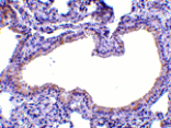 Immunohistochemistry - SLPI Antibody from Signalway Antibody (24542) - Antibodies.com