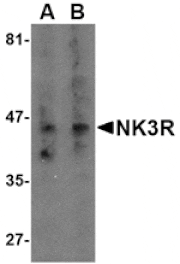 Western blot - NK3R Antibody from Signalway Antibody (24544) - Antibodies.com