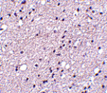 Immunohistochemistry - NK3R Antibody from Signalway Antibody (24544) - Antibodies.com