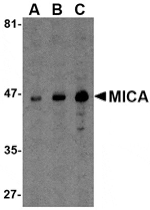 Western blot - MICA Antibody from Signalway Antibody (24546) - Antibodies.com