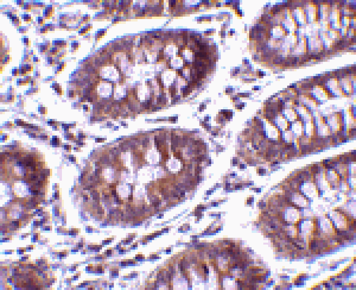 Immunohistochemistry - MICA Antibody from Signalway Antibody (24546) - Antibodies.com