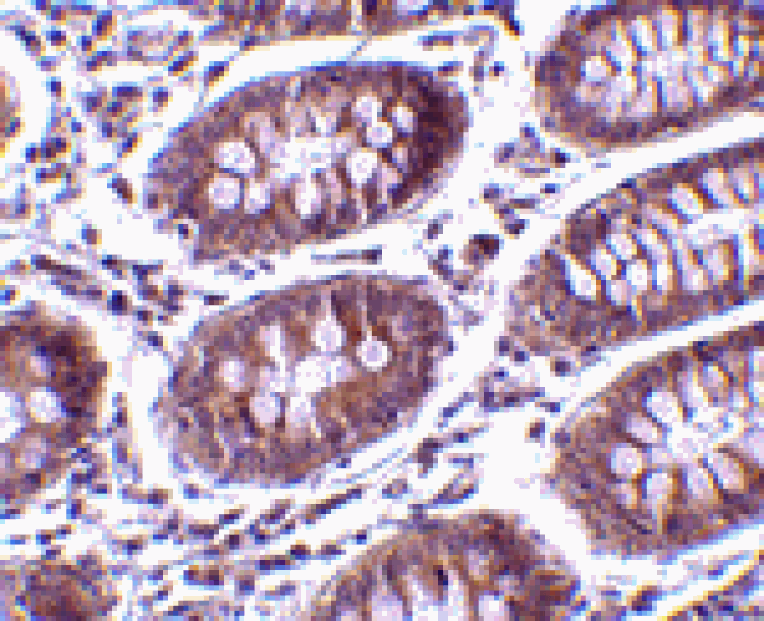 Immunohistochemistry - MICA Antibody from Signalway Antibody (24546) - Antibodies.com