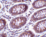 Immunohistochemistry - MICA Antibody from Signalway Antibody (24546) - Antibodies.com