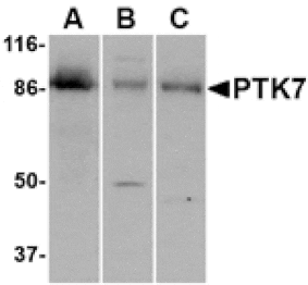 Western blot - PTK7 Antibody from Signalway Antibody (24563) - Antibodies.com