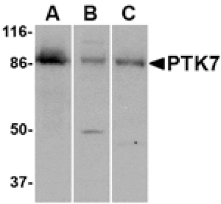 Western blot - PTK7 Antibody from Signalway Antibody (24563) - Antibodies.com
