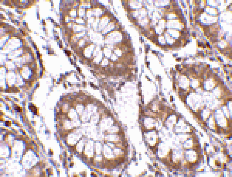 Immunohistochemistry - PTK7 Antibody from Signalway Antibody (24563) - Antibodies.com