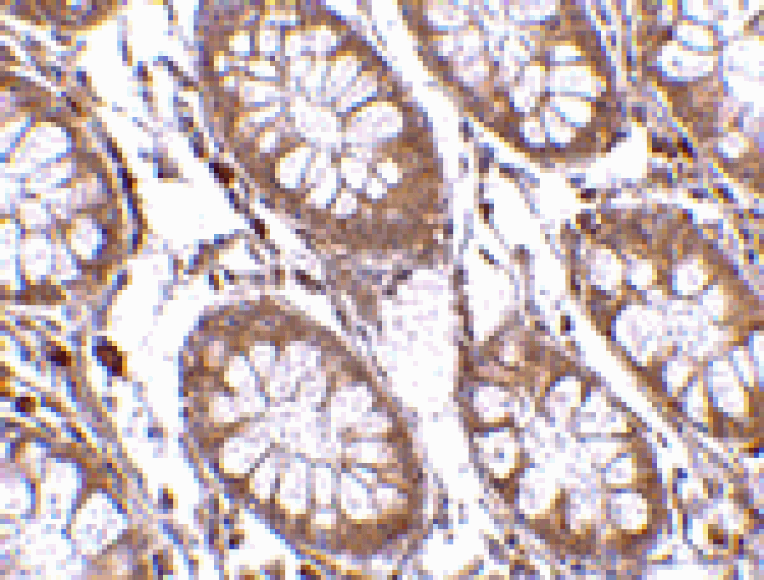 Immunohistochemistry - PTK7 Antibody from Signalway Antibody (24563) - Antibodies.com