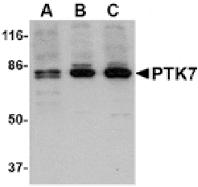 Western blot - PTK7 Antibody from Signalway Antibody (24564) - Antibodies.com