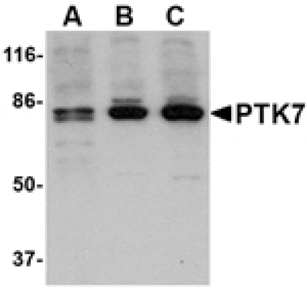 Western blot - PTK7 Antibody from Signalway Antibody (24564) - Antibodies.com