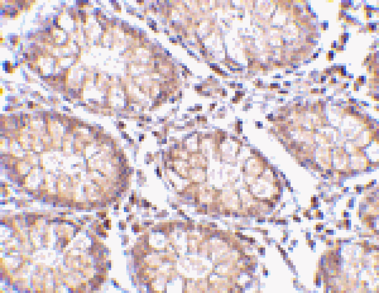 Immunohistochemistry - PTK7 Antibody from Signalway Antibody (24564) - Antibodies.com