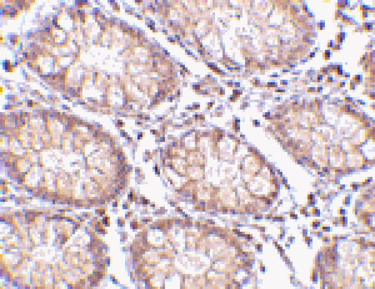 Immunohistochemistry - PTK7 Antibody from Signalway Antibody (24564) - Antibodies.com