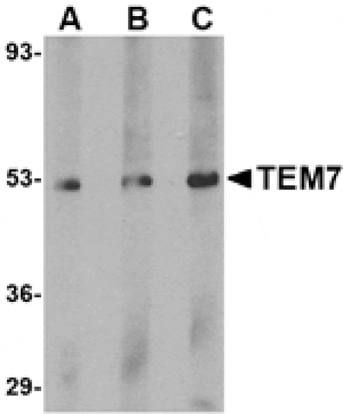 Western blot - TEM7 Antibody from Signalway Antibody (24580) - Antibodies.com