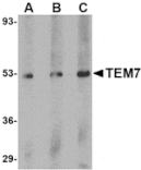 Western blot - TEM7 Antibody from Signalway Antibody (24580) - Antibodies.com