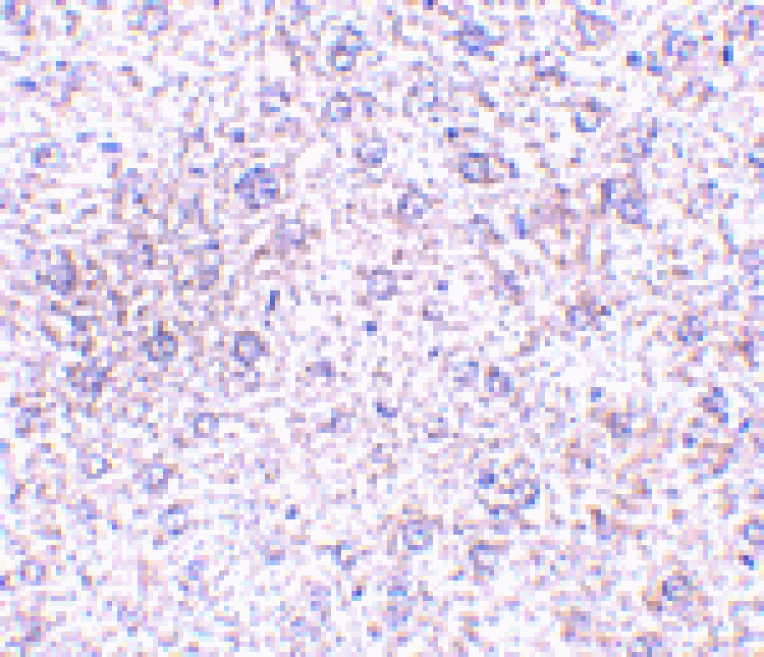 Immunohistochemistry - TEM7 Antibody from Signalway Antibody (24580) - Antibodies.com