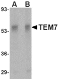 Western blot - TEM7 Antibody from Signalway Antibody (24581) - Antibodies.com