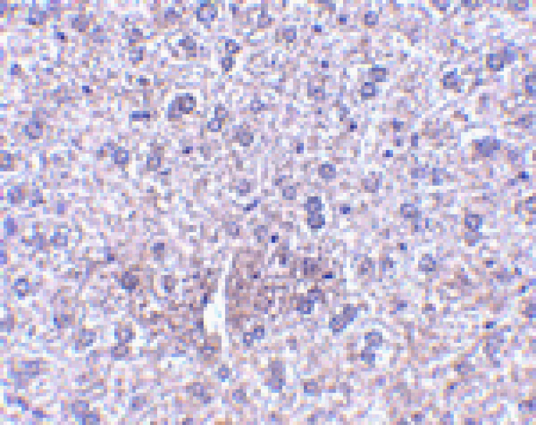 Immunohistochemistry - TEM7 Antibody from Signalway Antibody (24581) - Antibodies.com