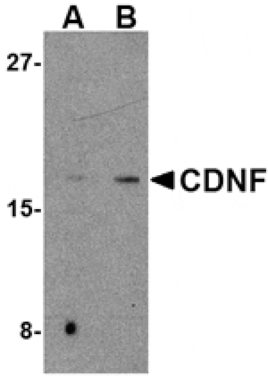 Western blot - CDNF Antibody from Signalway Antibody (24582) - Antibodies.com