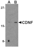 Western blot - CDNF Antibody from Signalway Antibody (24582) - Antibodies.com