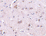 Immunohistochemistry - CDNF Antibody from Signalway Antibody (24582) - Antibodies.com