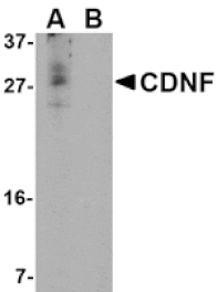 Western blot - CDNF Antibody from Signalway Antibody (24583) - Antibodies.com