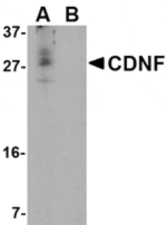 Western blot - CDNF Antibody from Signalway Antibody (24583) - Antibodies.com