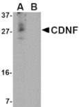 Western blot - CDNF Antibody from Signalway Antibody (24583) - Antibodies.com