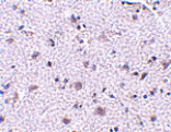Immunohistochemistry - CDNF Antibody from Signalway Antibody (24583) - Antibodies.com