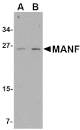 Western blot - MANF Antibody from Signalway Antibody (24584) - Antibodies.com