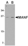 Western blot - MANF Antibody from Signalway Antibody (24584) - Antibodies.com