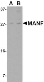 Western blot - MANF Antibody from Signalway Antibody (24585) - Antibodies.com