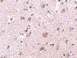 Immunohistochemistry - MANF Antibody from Signalway Antibody (24585) - Antibodies.com