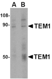 Western blot - TEM1 Antibody from Signalway Antibody (24589) - Antibodies.com