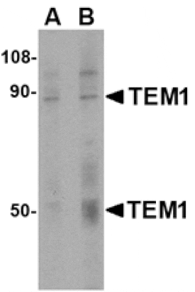 Western blot - TEM1 Antibody from Signalway Antibody (24589) - Antibodies.com
