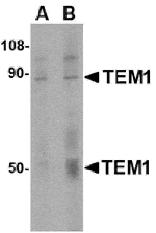 Western blot - TEM1 Antibody from Signalway Antibody (24589) - Antibodies.com