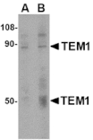 Western blot - TEM1 Antibody from Signalway Antibody (24589) - Antibodies.com
