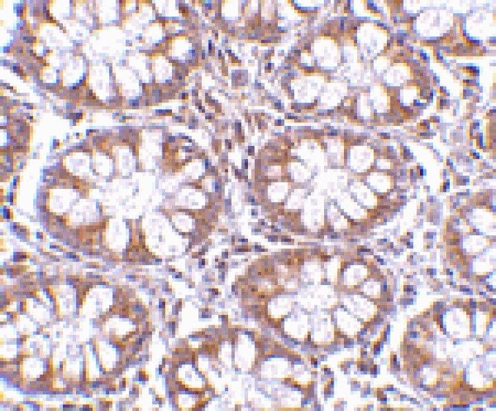 Immunohistochemistry - TEM1 Antibody from Signalway Antibody (24589) - Antibodies.com