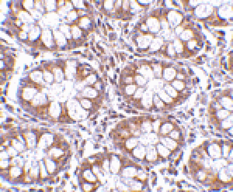 Immunohistochemistry - TEM1 Antibody from Signalway Antibody (24589) - Antibodies.com
