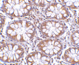 Immunohistochemistry - TEM1 Antibody from Signalway Antibody (24589) - Antibodies.com