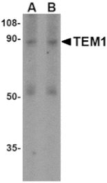 Western blot - TEM1 Antibody from Signalway Antibody (24590) - Antibodies.com