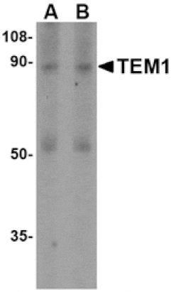 Western blot - TEM1 Antibody from Signalway Antibody (24590) - Antibodies.com