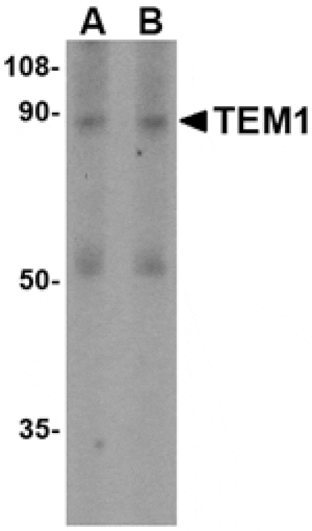 Western blot - TEM1 Antibody from Signalway Antibody (24590) - Antibodies.com