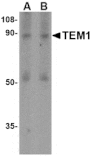 Western blot - TEM1 Antibody from Signalway Antibody (24590) - Antibodies.com