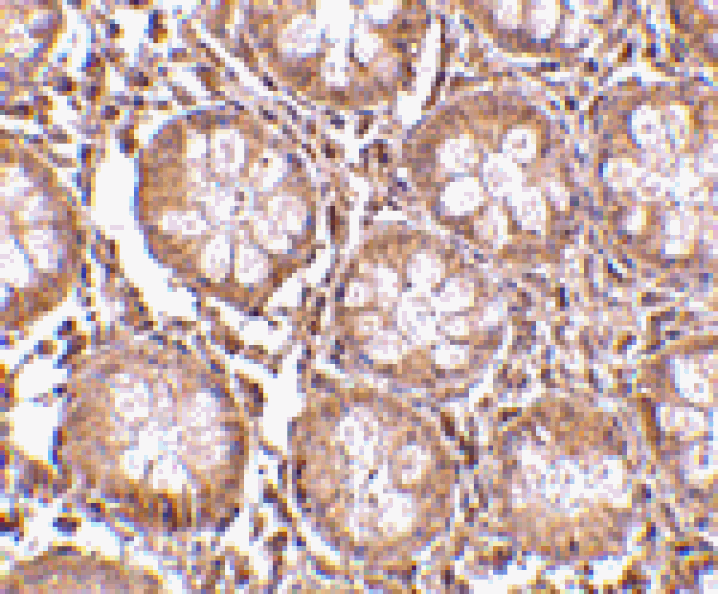 Immunohistochemistry - TEM1 Antibody from Signalway Antibody (24590) - Antibodies.com