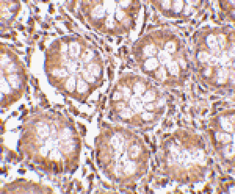 Immunohistochemistry - TEM1 Antibody from Signalway Antibody (24590) - Antibodies.com