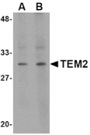 Western blot - TEM2 Antibody from Signalway Antibody (24591) - Antibodies.com