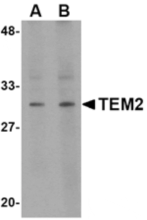 Western blot - TEM2 Antibody from Signalway Antibody (24591) - Antibodies.com